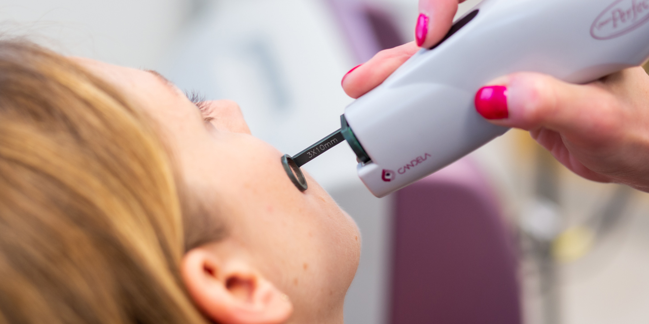 Laser Therapy for Unwanted Blood Vessels - Peraza Dermatology Group
