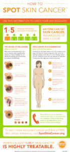How to SPOT Skin Cancer Infographic